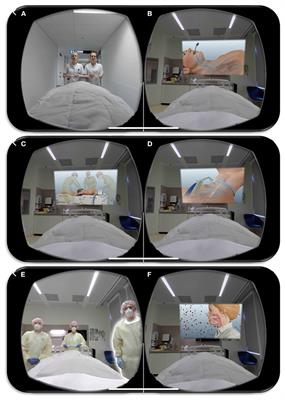 Intensive Care Unit-Specific Virtual Reality for Psychological Recovery After ICU Treatment for COVID-19; A Brief Case Report